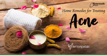 Home remedies for treating acne