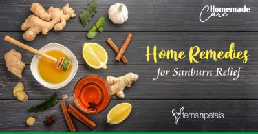 Home Remedies for Sunburn Relief
