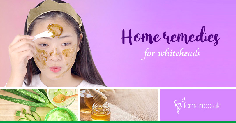 Perfect Home Remedies To Get Rid Off Whiteheads